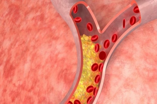 yến mạch giảm cholesterol