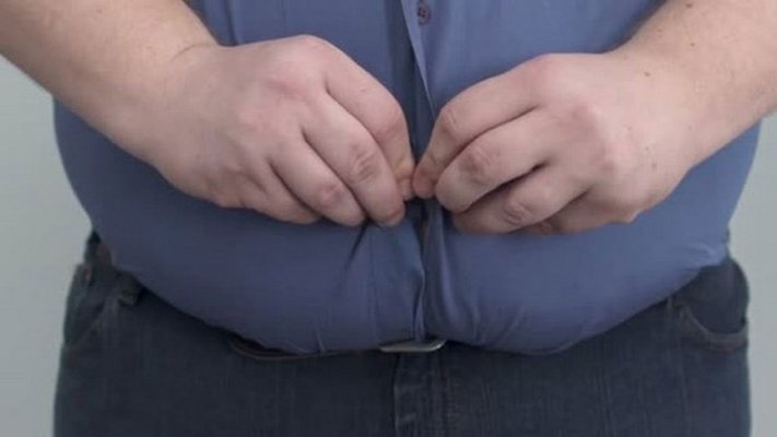 béo phì nên hạn chế ăn